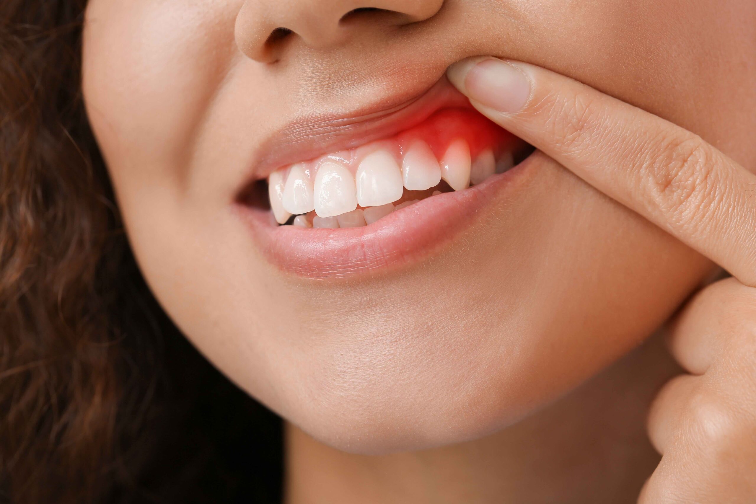 Close-up of a Colorado Springs, CO dentist examining a patient's gums for signs of gum disease at Cheyenne Mountain Dental Care